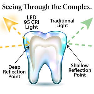 light traveling through tooth layers pic